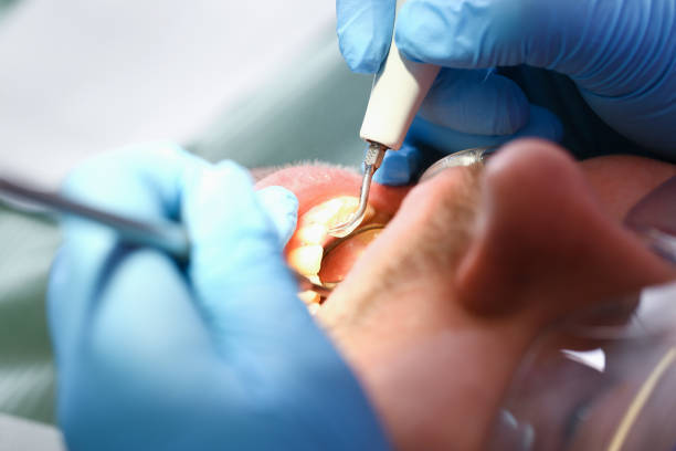 Best Emergency Root Canal Therapy in North Windham, ME